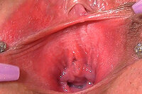 Free Gape My Pussy Sign Up s3